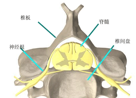 颈椎病