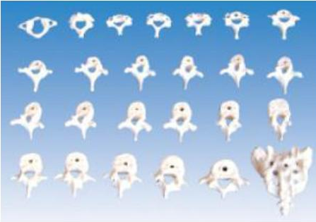 康人 椎骨功能变化示教模型 KAR/11208