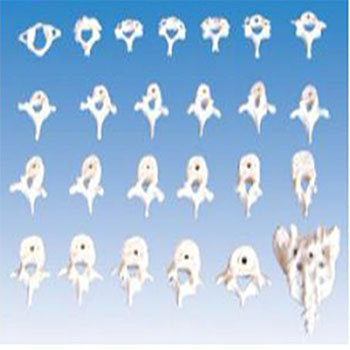 椎骨功能变化示教模型 KAR/11208