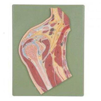 肩关节剖面模型 KAR/11202