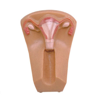 女性宫内避孕器及训练模型 KAR/B3