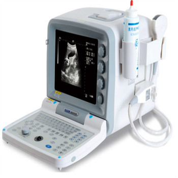 凯信便携式B超机 KX2000G