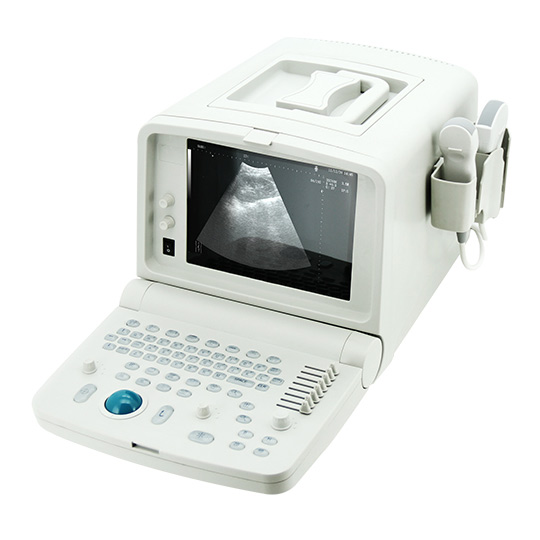 CONTEC 康泰便携式B超机 CMS600C