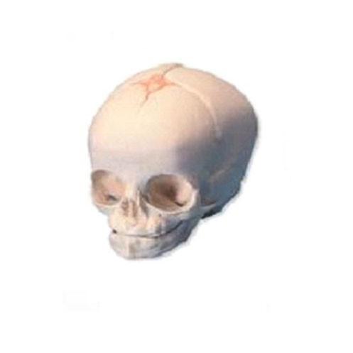  婴儿头颅骨模型KAR/11115