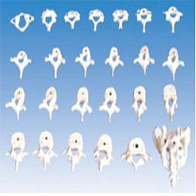  椎骨功能变化示教模型KAR/11208