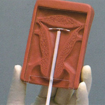  高级宫内避孕器训练模型KAR/B5