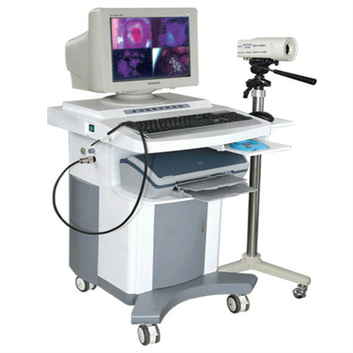 圣普多功能电子阴道镜SPD-1C型