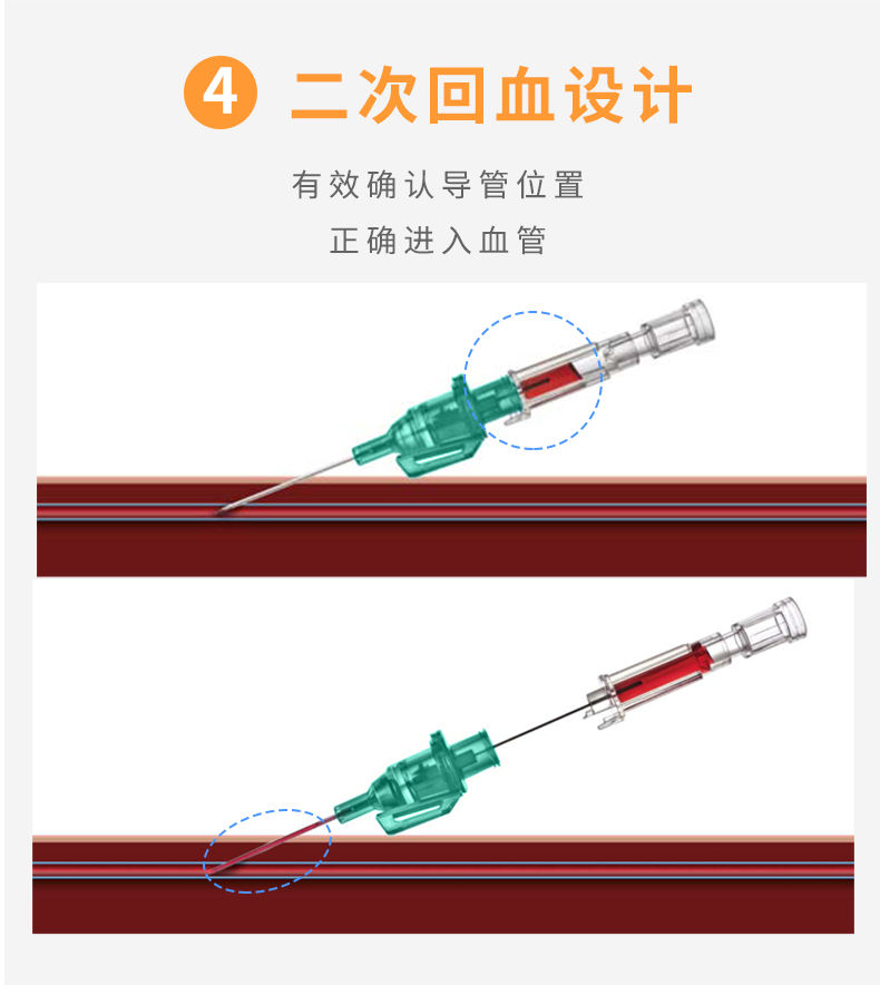 德国贝朗Introcan Safety-W 英全康18G 安全型 带翼动静脉留置针