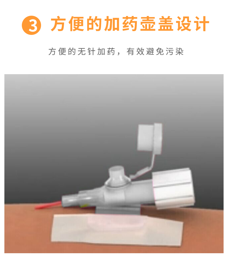 沃素安16G动静脉留置针