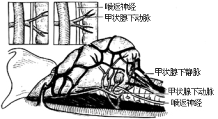 图3 甲状腺下动脉和喉返神经的关系